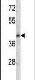 SERPINA9 Antibody in Western Blot (WB)