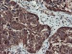 SERPINB1 Antibody in Immunohistochemistry (Paraffin) (IHC (P))