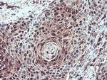 SERPINB1 Antibody in Immunohistochemistry (Paraffin) (IHC (P))