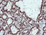 SERPINB1 Antibody in Immunohistochemistry (Paraffin) (IHC (P))