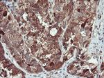 SERPINB1 Antibody in Immunohistochemistry (Paraffin) (IHC (P))