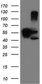 SERPINB1 Antibody in Western Blot (WB)