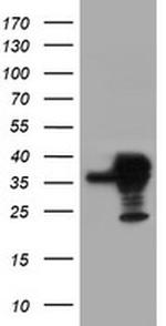 SERPINB1 Antibody in Western Blot (WB)