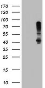 SERPINB1 Antibody in Western Blot (WB)