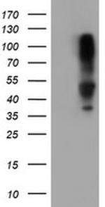 SERPINB1 Antibody in Western Blot (WB)