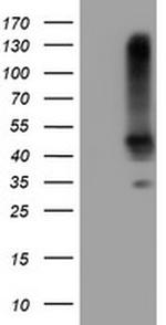 SERPINB1 Antibody in Western Blot (WB)