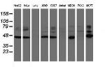 SERPINB1 Antibody in Western Blot (WB)