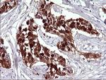 SERPINB3 Antibody in Immunohistochemistry (Paraffin) (IHC (P))