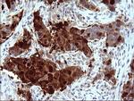 SERPINB3 Antibody in Immunohistochemistry (Paraffin) (IHC (P))