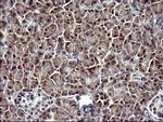 SERPINB3 Antibody in Immunohistochemistry (Paraffin) (IHC (P))