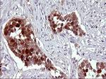 SERPINB3 Antibody in Immunohistochemistry (Paraffin) (IHC (P))