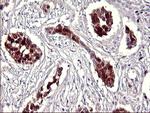 SERPINB3 Antibody in Immunohistochemistry (Paraffin) (IHC (P))