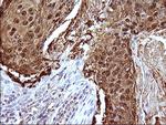 SERPINB3 Antibody in Immunohistochemistry (Paraffin) (IHC (P))