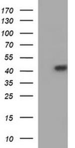 SERPINB3 Antibody in Western Blot (WB)