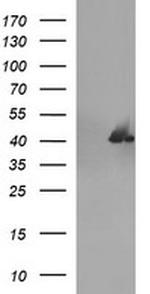 SERPINB3 Antibody in Western Blot (WB)