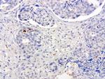 SERPINB4 Antibody in Immunohistochemistry (Paraffin) (IHC (P))