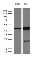 SERPINB8 Antibody in Western Blot (WB)