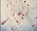 Neuroserpin Antibody in Immunohistochemistry (IHC)