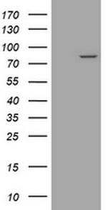 SESTD1 Antibody in Western Blot (WB)