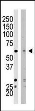 SETD8 Antibody in Western Blot (WB)
