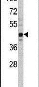 SETD8 Antibody in Western Blot (WB)