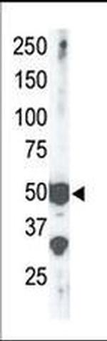 SETD7 Antibody in Western Blot (WB)