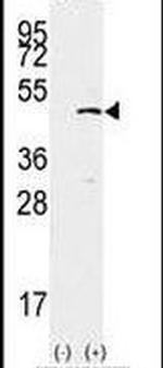 SETD7 Antibody in Western Blot (WB)