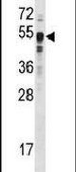 SETD7 Antibody in Western Blot (WB)