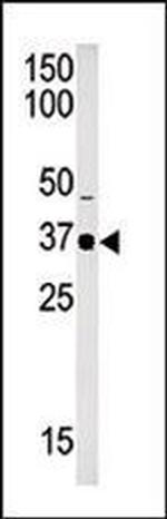 SETD7 Antibody in Western Blot (WB)
