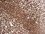 SETD1A Antibody in Immunohistochemistry (Paraffin) (IHC (P))