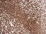SETD1A Antibody in Immunohistochemistry (Paraffin) (IHC (P))