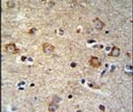 SETD6 Antibody in Immunohistochemistry (IHC)