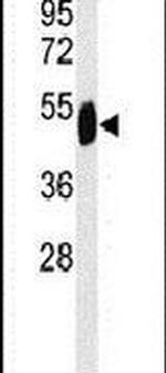 SETD6 Antibody in Western Blot (WB)