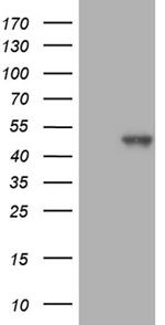 SETD8 Antibody in Western Blot (WB)