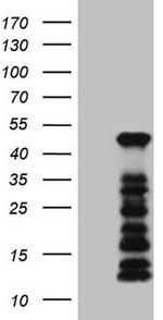 SETD8 Antibody in Western Blot (WB)
