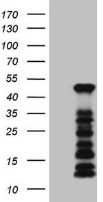 SETD8 Antibody in Western Blot (WB)