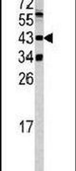 SETD8 Antibody in Western Blot (WB)
