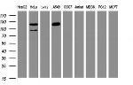 SF3A1 Antibody in Western Blot (WB)