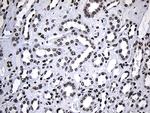 SF3B14 Antibody in Immunohistochemistry (Paraffin) (IHC (P))