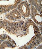 14-3-3 sigma Antibody in Immunohistochemistry (IHC)