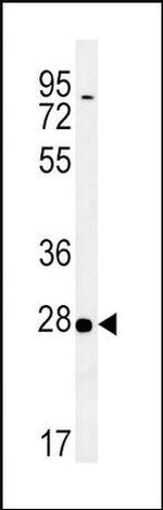 14-3-3 sigma Antibody in Western Blot (WB)