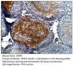 SFRP5 Polyclonal Antibody