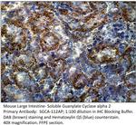 Soluble Guanylyl Cyclase alpha 2 Polyclonal Antibody