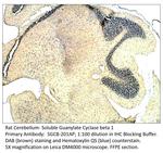 Soluble Guanylyl Cyclase beta 1 Polyclonal Antibody