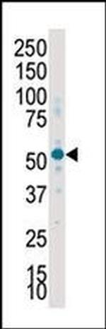 SGK2 Antibody in Western Blot (WB)