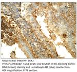 SGK3 Polyclonal Antibody