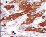 SGK3 Antibody in Immunohistochemistry (IHC)