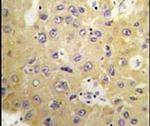 SGK3 Antibody in Immunohistochemistry (IHC)