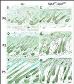 SGK3 Antibody in Immunohistochemistry (IHC)