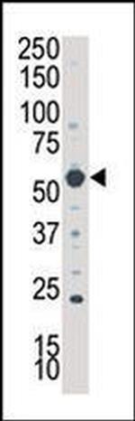 SGK3 Antibody in Western Blot (WB)